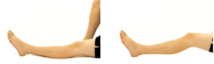 glenferriessc knee excercise | Glenferrie Sports and Spinal Clinic glenferriessc knee excercise